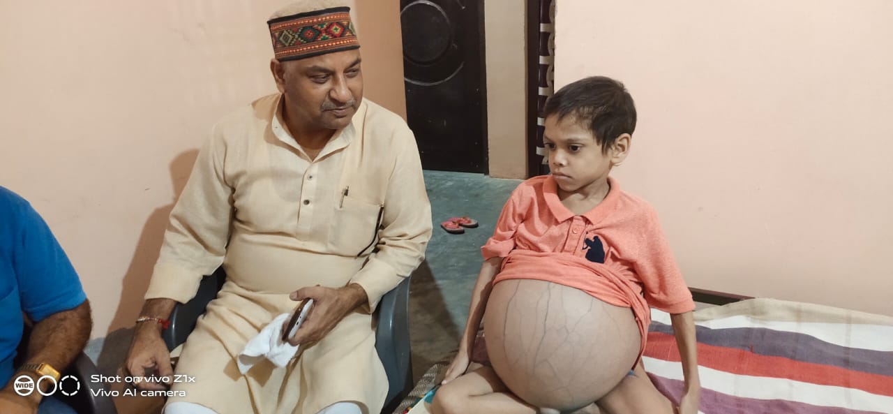 भाजपा नेता डॉ रमेश दुबे ने थैलसीमिया बीमारी से पीड़ित बच्चे का सरकार से इलाज करवाने का आश्वासन दिया । 
